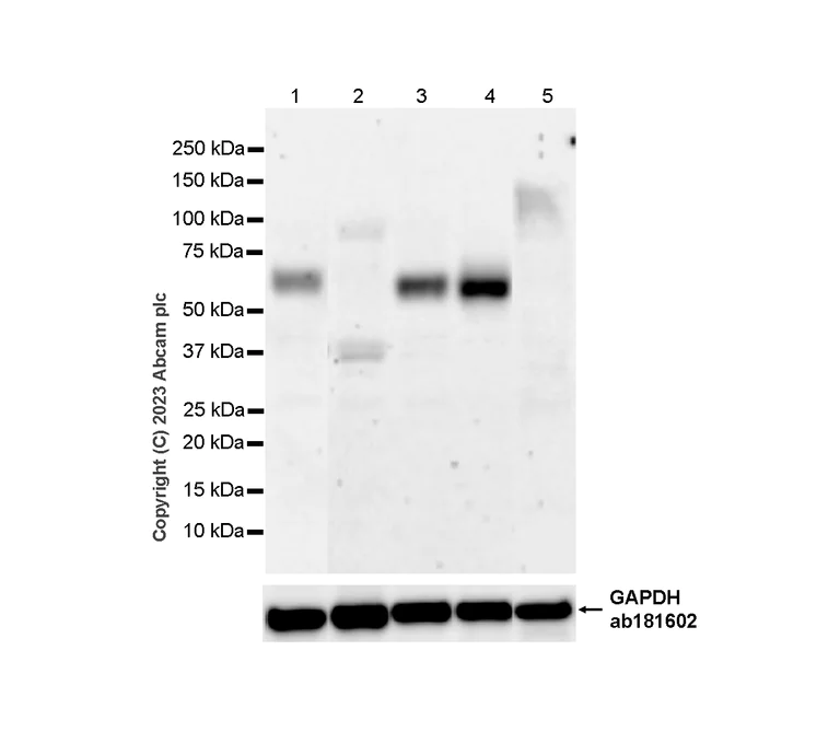 Western blot - Anti-Noradrenaline transporter antibody [EPR23527-534] (AB254361)