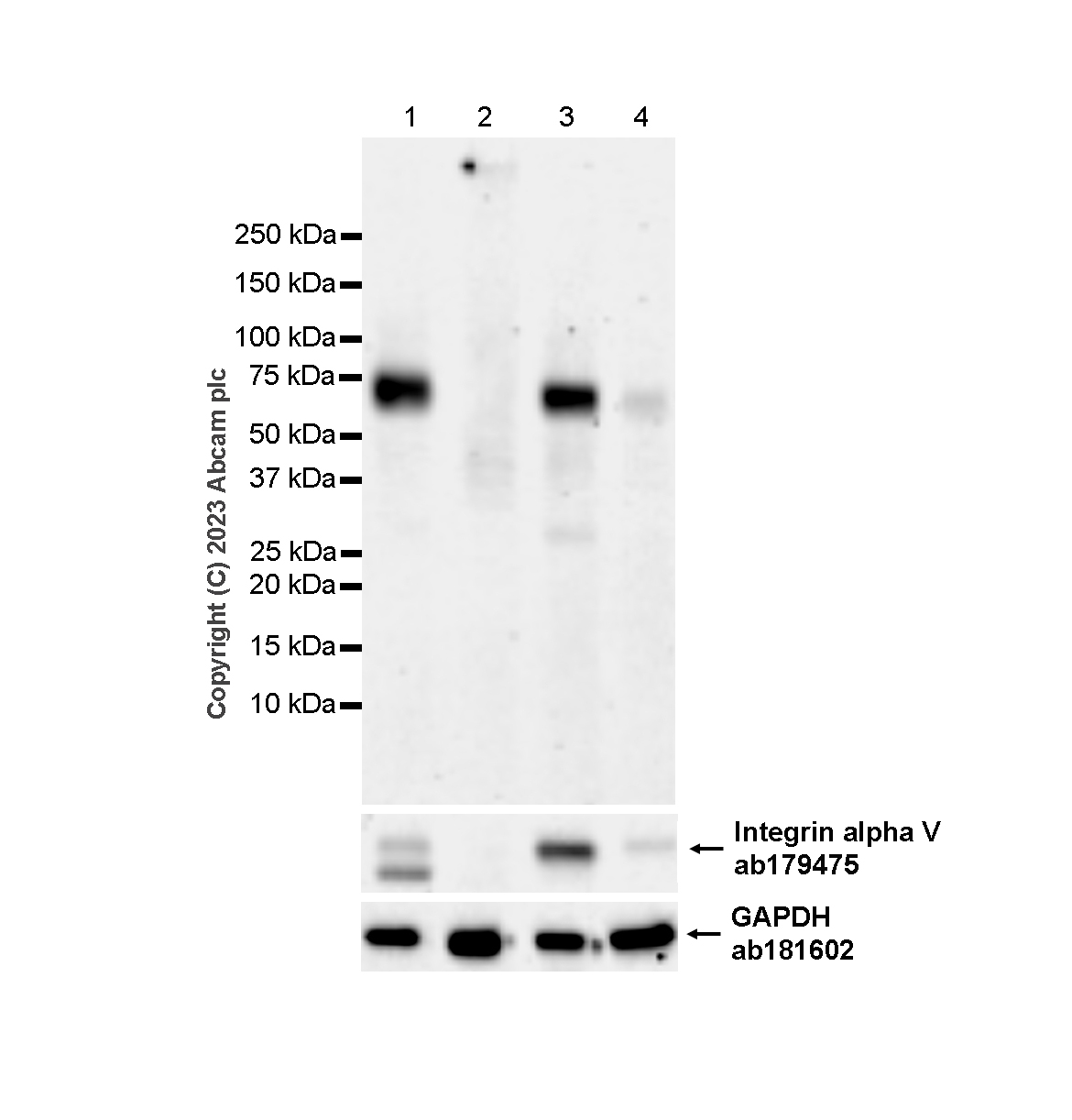 Western blot - Anti-Noradrenaline transporter antibody [EPR23527-534] (ab254361), expandable thumbnail