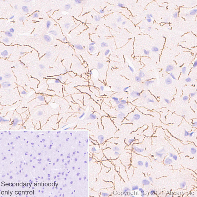 Immunohistochemistry (Formalin/PFA-fixed paraffin-embedded sections) - Anti-Noradrenaline transporter antibody [EPR23527-534] - BSA and Azide free (AB282022)