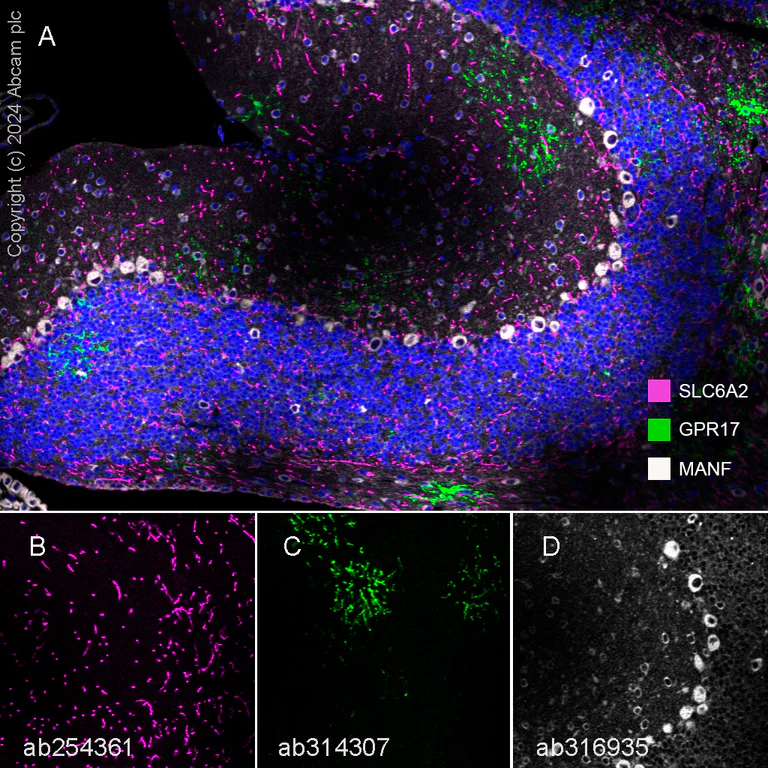 Multiplex immunohistochemistry - Anti-Noradrenaline transporter antibody [EPR23527-534] - BSA and Azide free (AB282022)