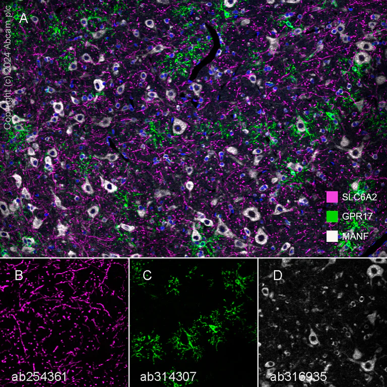 Multiplex immunohistochemistry - Anti-Noradrenaline transporter antibody [EPR23527-534] - BSA and Azide free (AB282022)