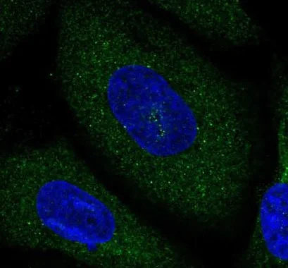 Immunocytochemistry/ Immunofluorescence - Anti-Norbin antibody (AB224451)