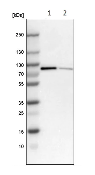 Western blot - Anti-Norbin antibody (AB224451)