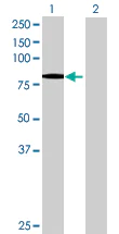 Western blot - Anti-Norbin antibody (AB88877)