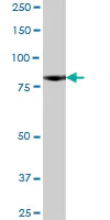 Western blot - Anti-Norbin antibody (AB88877)
