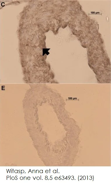 Immunohistochemistry (Frozen sections) - Normal Goat Serum (AB7481)