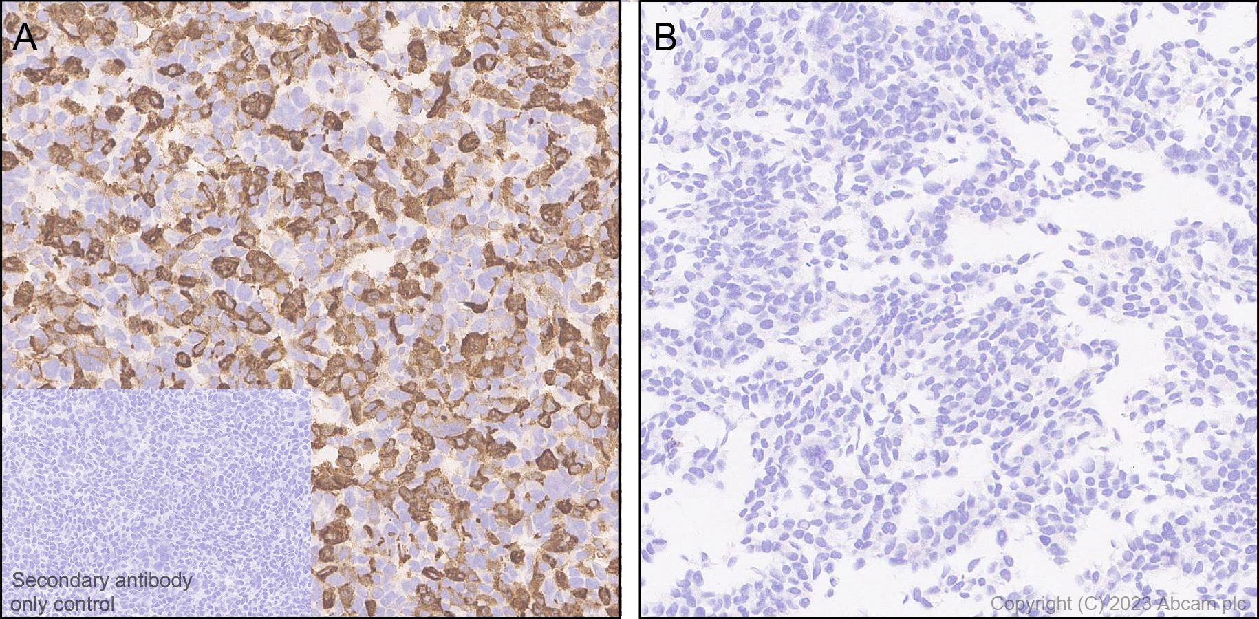 Immunohistochemistry (Formalin/PFA-fixed paraffin-embedded sections) - Anti-Norovirus Capsid protein VP1 antibody [EPR27186-20] - BSA and Azide free (AB308069), expandable thumbnail