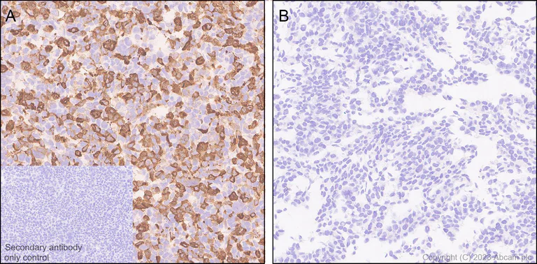 Immunohistochemistry (Formalin/PFA-fixed paraffin-embedded sections) - Anti-Norovirus Capsid protein VP1 antibody [EPR27186-20] - BSA and Azide free (AB308069)