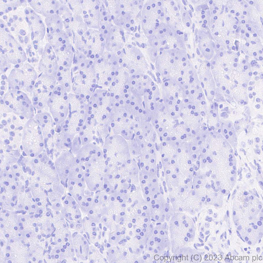 Immunohistochemistry (Formalin/PFA-fixed paraffin-embedded sections) - Anti-Norovirus Capsid protein VP1 antibody [EPR27186-20] - BSA and Azide free (AB308069), expandable thumbnail