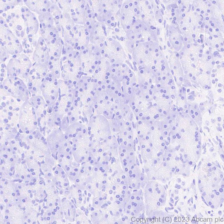 Immunohistochemistry (Formalin/PFA-fixed paraffin-embedded sections) - Anti-Norovirus Capsid protein VP1 antibody [EPR27186-20] - BSA and Azide free (AB308069)