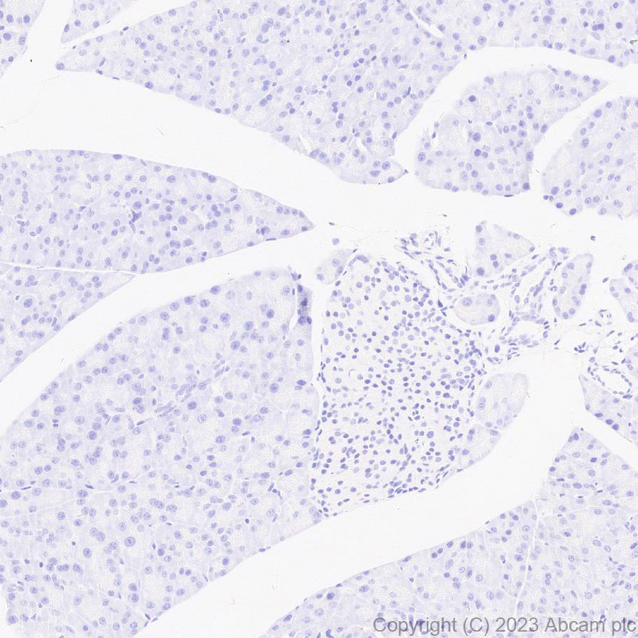 Immunohistochemistry (Formalin/PFA-fixed paraffin-embedded sections) - Anti-Norovirus Capsid protein VP1 antibody [EPR27186-20] - BSA and Azide free (AB308069), expandable thumbnail