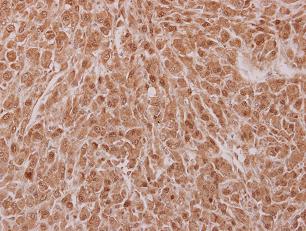 Immunohistochemistry (Formalin/PFA-fixed paraffin-embedded sections) - Anti-NOSIP antibody (AB102087), expandable thumbnail