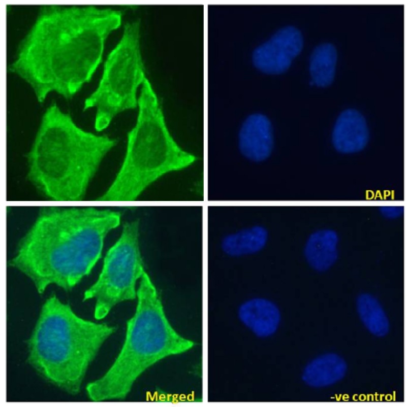 Immunocytochemistry/ Immunofluorescence - Anti-Notch1 antibody [E6] (AB245686), expandable thumbnail