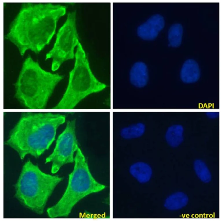 Immunocytochemistry/ Immunofluorescence - Anti-Notch1 antibody [E6] (AB245686)