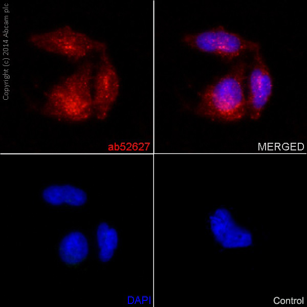Immunocytochemistry/ Immunofluorescence - Anti-Notch1 antibody [EP1238Y] (ab52627), expandable thumbnail