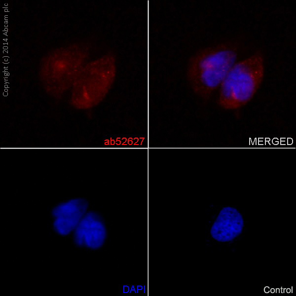 Immunocytochemistry/ Immunofluorescence - Anti-Notch1 antibody [EP1238Y] (ab52627), expandable thumbnail