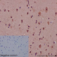 Immunohistochemistry (Formalin/PFA-fixed paraffin-embedded sections) - Anti-Notch1 antibody [EP1238Y] (ab52627), expandable thumbnail