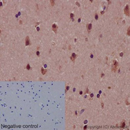 Immunohistochemistry (Formalin/PFA-fixed paraffin-embedded sections) - Anti-Notch1 antibody [EP1238Y] (AB52627), expandable thumbnail