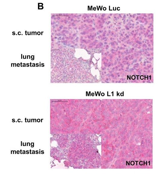 Immunohistochemistry (Formalin/PFA-fixed paraffin-embedded sections) - Anti-Notch1 antibody [EP1238Y] (AB52627), expandable thumbnail