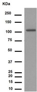 Western blot - Anti-Notch1 antibody [EP1238Y] (AB52627), expandable thumbnail