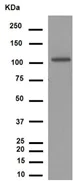 Western blot - Anti-Notch1 antibody [EP1238Y] (AB52627)