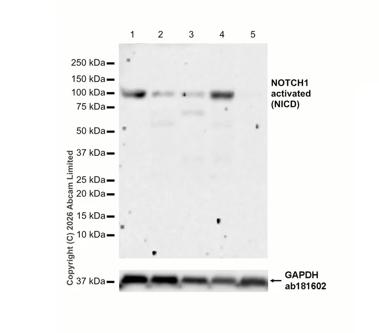 Western blot - Anti-Notch1 antibody [EP1238Y] (AB52627)