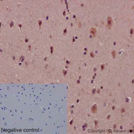 Immunohistochemistry (Formalin/PFA-fixed paraffin-embedded sections) - Anti-Notch1 antibody [EP1238Y] - Low endotoxin, Azide free (AB246693)