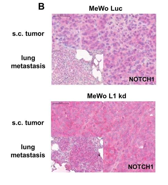 Immunohistochemistry (Formalin/PFA-fixed paraffin-embedded sections) - Anti-Notch1 antibody [EP1238Y] - Low endotoxin, Azide free (AB246693)