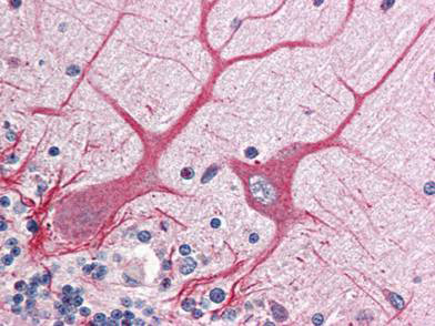 Immunohistochemistry (Formalin/PFA-fixed paraffin-embedded sections) - Anti-Notch1 intracellular domain antibody (AB8387), expandable thumbnail