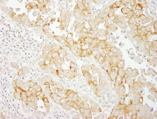 Immunohistochemistry (Formalin/PFA-fixed paraffin-embedded sections) - Anti-Notch2 antibody (AB245325), expandable thumbnail