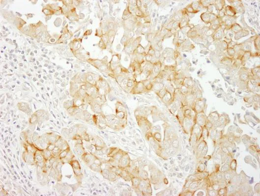 Immunohistochemistry (Formalin/PFA-fixed paraffin-embedded sections) - Anti-Notch2 antibody (AB245325)