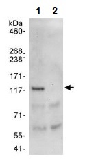 Immunoprecipitation - Anti-Notch2 antibody (AB245325), expandable thumbnail