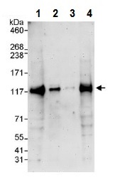 Western blot - Anti-Notch2 antibody (AB245325), expandable thumbnail