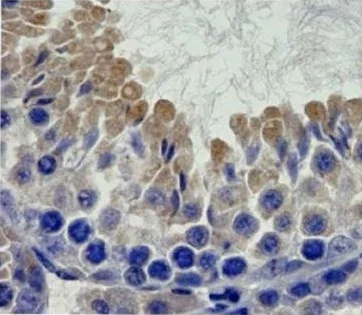 Immunohistochemistry (Formalin/PFA-fixed paraffin-embedded sections) - Anti-Notch2 antibody (AB8926)