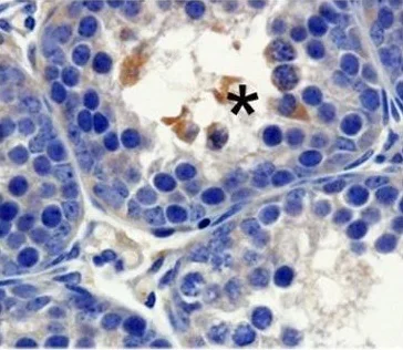 Immunohistochemistry (Formalin/PFA-fixed paraffin-embedded sections) - Anti-Notch2 antibody (AB8926)