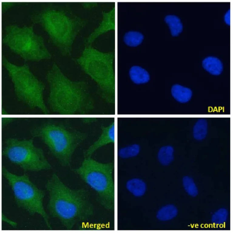 Immunocytochemistry/ Immunofluorescence - Anti-Notch2 antibody [B9] (AB245699)