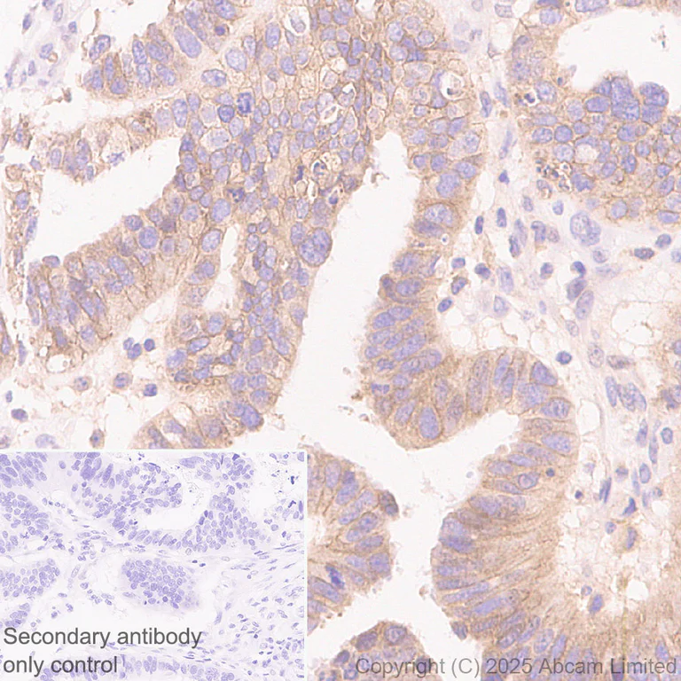 Immunohistochemistry (Formalin/PFA-fixed paraffin-embedded sections) - Anti-Notch2 antibody [EPR23715-107] (AB323806)