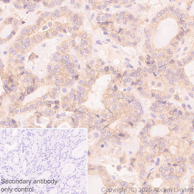 Immunohistochemistry (Formalin/PFA-fixed paraffin-embedded sections) - Anti-Notch2 antibody [EPR23715-107] (AB323806)