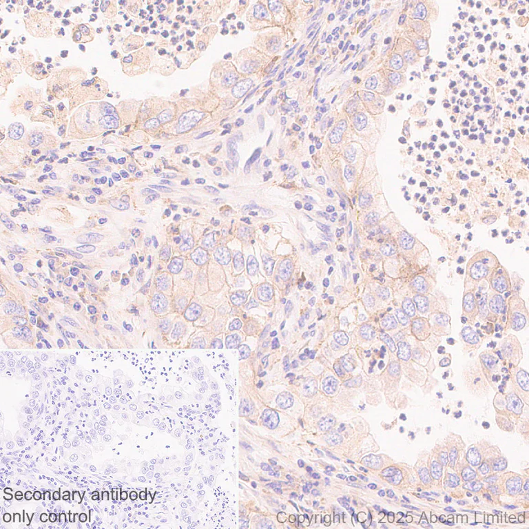Immunohistochemistry (Formalin/PFA-fixed paraffin-embedded sections) - Anti-Notch2 antibody [EPR23715-107] (AB323806)