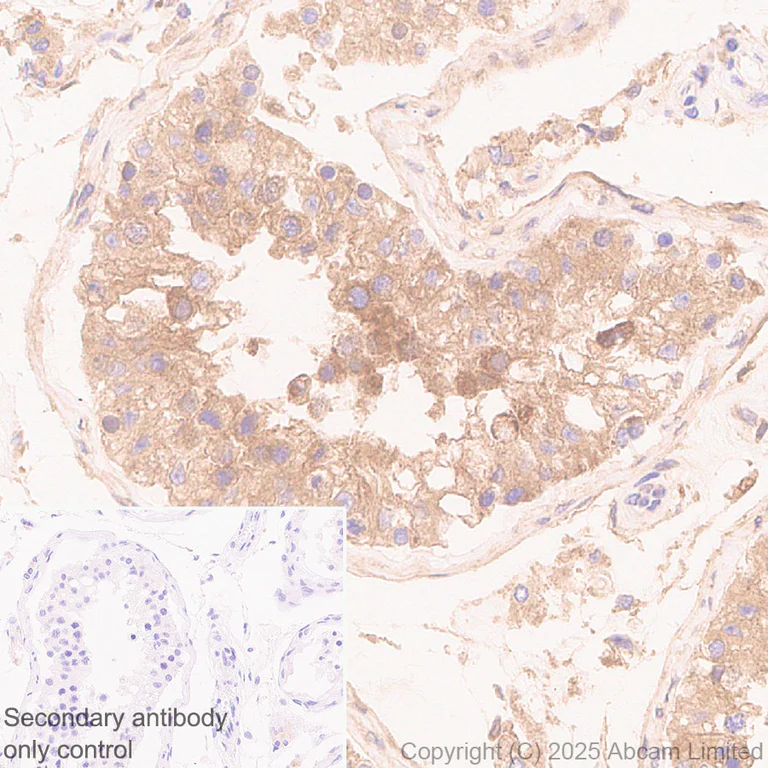 Immunohistochemistry (Formalin/PFA-fixed paraffin-embedded sections) - Anti-Notch2 antibody [EPR23715-107] (AB323806)