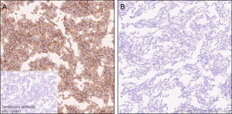 Immunohistochemistry (Formalin/PFA-fixed paraffin-embedded sections) - Anti-Notch2 antibody [EPR23715-107] (AB323806)