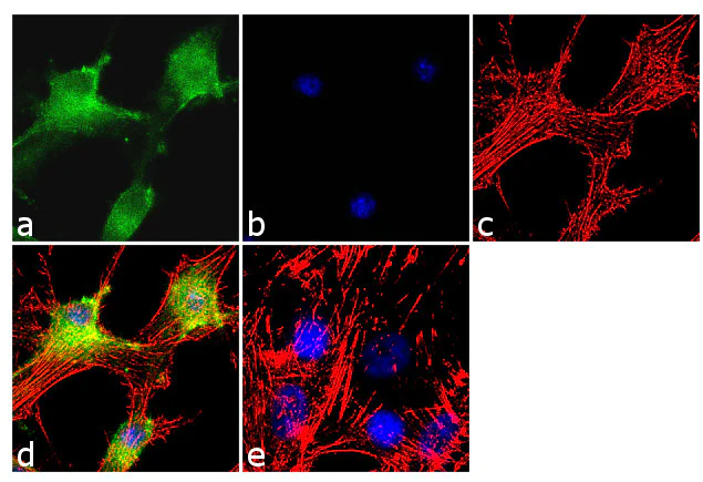 Immunocytochemistry/ Immunofluorescence - Anti-Notch2 Antibody [RP23040135] (AB313453)