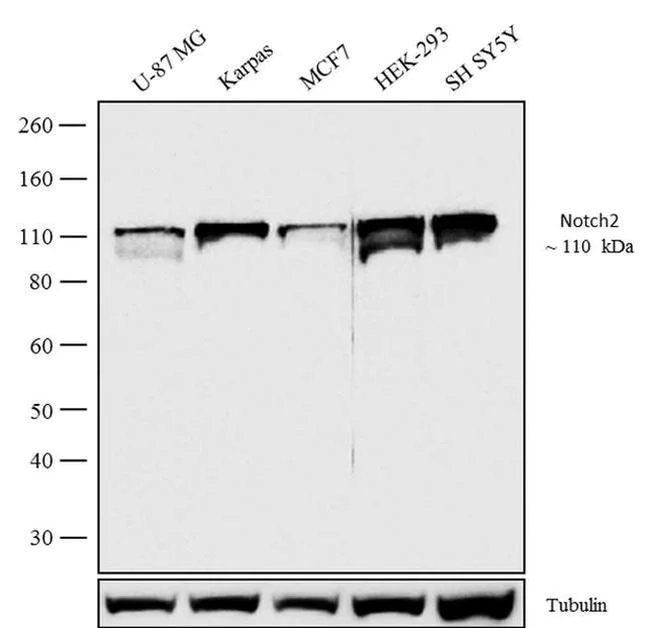Western blot - Anti-Notch2 Antibody [RP23040135] (AB313453)