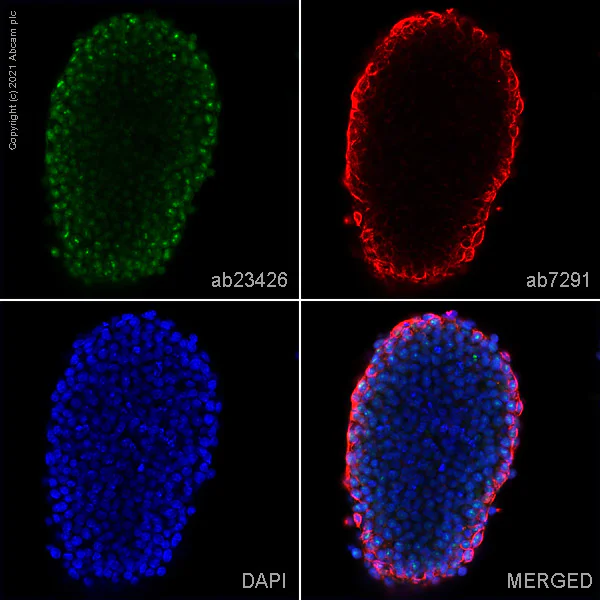 Immunocytochemistry/ Immunofluorescence - Anti-NOTCH3 antibody (AB23426)