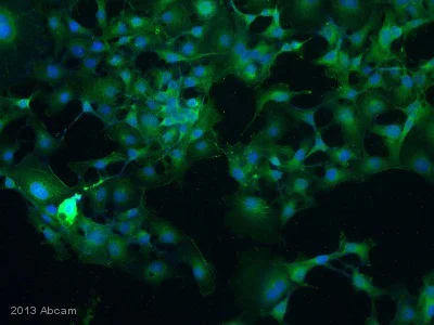 Immunocytochemistry/ Immunofluorescence - Anti-NOTCH3 antibody (AB23426)
