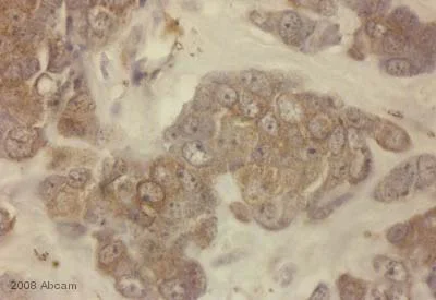 Immunohistochemistry (Formalin/PFA-fixed paraffin-embedded sections) - Anti-NOTCH3 antibody (AB23426)
