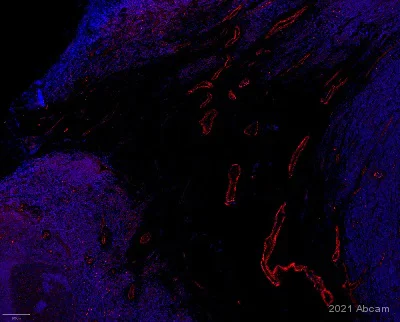 Immunohistochemistry (Formalin/PFA-fixed paraffin-embedded sections) - Anti-NOTCH3 antibody (AB23426)