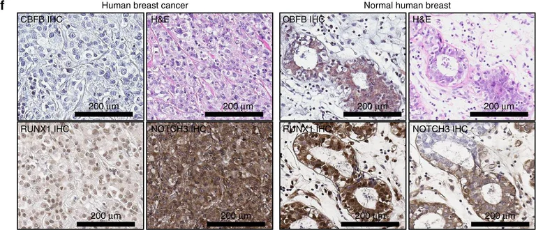 Immunohistochemistry - Anti-NOTCH3 antibody (AB23426)
