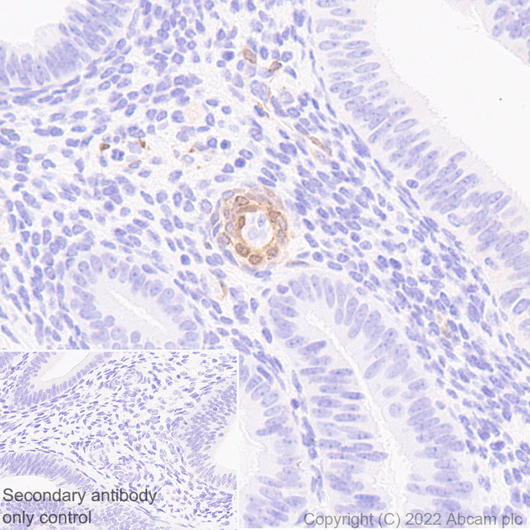 Immunohistochemistry (Formalin/PFA-fixed paraffin-embedded sections) - Anti-NOTCH3 antibody [EPR25183-101] (AB300527)