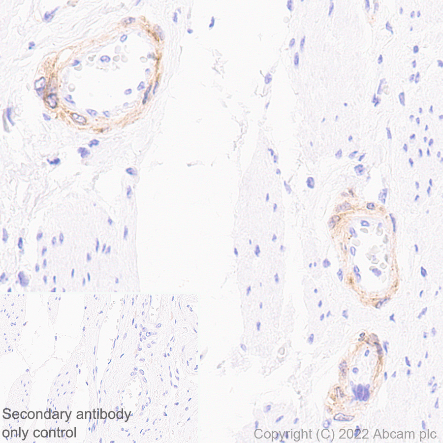 Immunohistochemistry (Formalin/PFA-fixed paraffin-embedded sections) - Anti-NOTCH3 antibody [EPR25183-101] (AB300527)